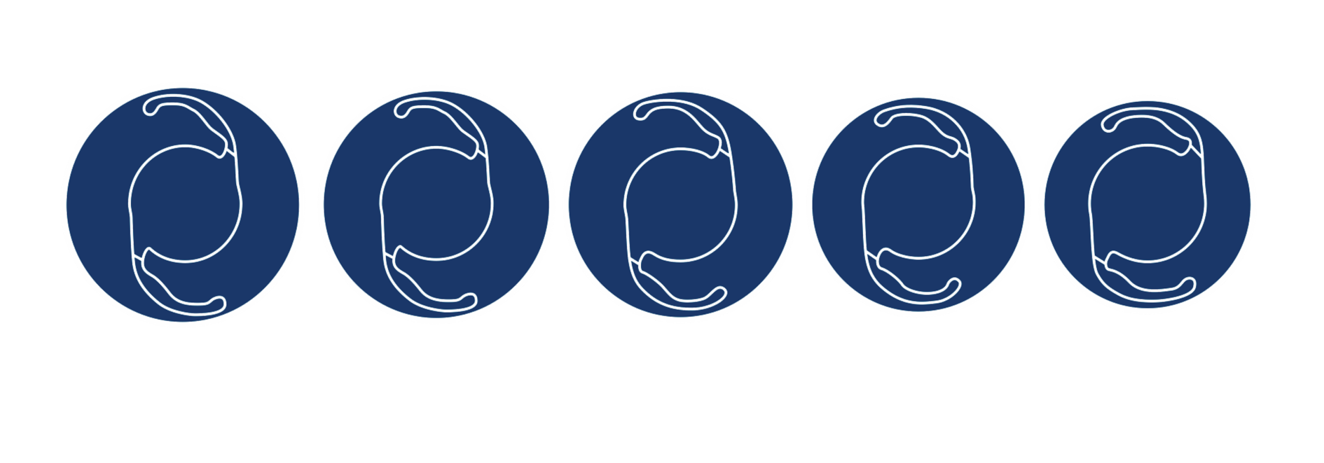 Icons representing five different toric intraocular lens (IOL) designs shown as white outlines on blue circles