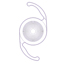 Trifocal Lens image