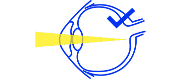 eyeball icon