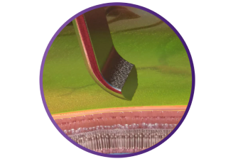 Close up of the SHARKSKIN ILM forceps touching ILM tissue.